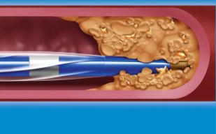 57eb00f9a90f364bba36d35e84d84a7